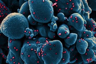 Newsblog Coronavirus - die aktuelle Entwicklung -