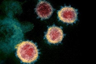 Newsblog Coronavirus - die aktuelle Entwicklung - Eine elektronenmikroskopische Aufnahme des Coronavirus (SARS-CoV-2), das Covid-19 verursacht. 