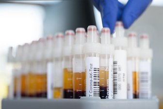 Newsblog Coronavirus - die aktuelle Entwicklung -