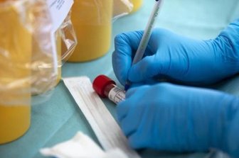 Newsblog Coronavirus - die aktuelle Entwicklung - Besonders hohe Zahlen registrierter Infektionen haben Bayern, Nordrhein-Westfalen sowie Baden-Württemberg.