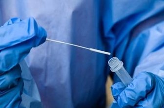 Omikron: Erster Verdachtsfall - Im Vogtlandkreis weist bei einer Reiserückkehrerin ein positiver PCR-Test auf die Virusvariante Omikron hin. 