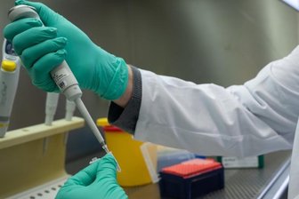 Omikron: Plan für kritische Infrastruktur - Ein Forscher zeigt, wie ein PCR-Test für die Analyse auf Mutationen des Coronavirus vorbereitet wird.