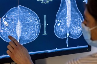 Patientinnenforum zu Brustkrebs im Klinikum Mittweida - Eine Ärztin untersucht Mammografie-Aufnahmen einer Frau auf verdächtige Veränderungen.