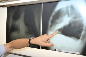 Radiologie-Aus in Bad Schlema: Patienten müssen weit fahren - Wo ist die nächste Radiologie, die Röntgen anbietet?