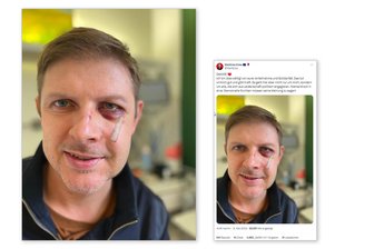 Rechtsextreme Straftaten in Deutschland auf Höchststand - Opfer Matthias Ecke muss noch eine OP durchstehen - Auf Twitter meldete sich der SPD-Europa-Politiker Matthias Ecke schon Tage nach dem Überfall aus dem Krankenhaus zu Wort, nachdem ihn zahlreiche Genesungswünsche und Solidaritätsbekundungen erreicht hatten.