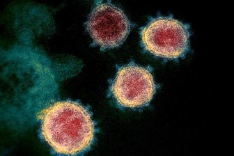Eine elektronenmikroskopische Aufnahme des Coronavirus (SARS-CoV-2), das Covid-19 verursacht.