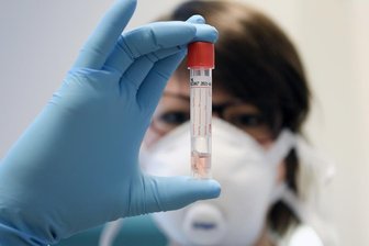 Sieben neue Corona-Fälle im Landkreis Zwickau: 59 neue Quarantänen - Sieben neue Coronafälle sind am Donnerstag im Landkreis Zwickau aufgetreten.