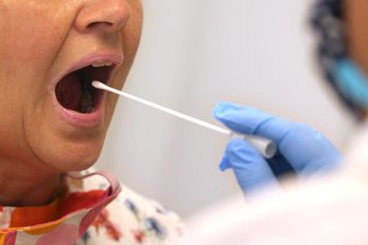 So öffnen die Testzentren an Feiertagen -