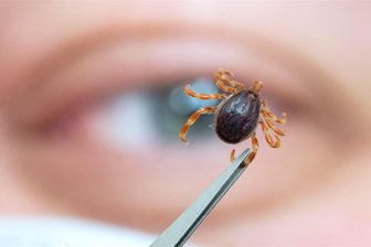 Sommerhitze: Wurde im Vogtland bereits die „Monsterzecke“ gesichtet? - Die Hyalomma-Zecke, auch „Monsterzecke“ genannt, unterscheidet sich optisch deutlich von heimischen Zeckenarten. Hat sie es schon bis in das Vogtland geschafft?