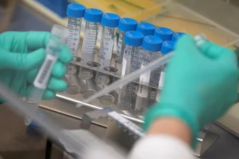Stärkster Anstieg seit April: 149 Corona-Neuinfektionen in Sachsen - 