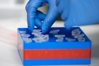Eine Laborantin führt Untersuchungen zum Coronavirus durch.