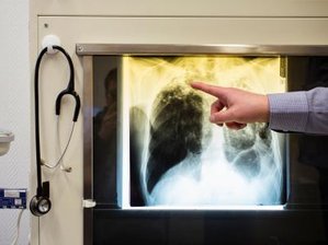 Studie: Ärzte röntgen zu häufig -