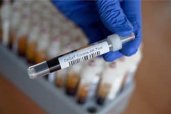 Tausende Probanden in Chemnitz sollen an Corona-Studie teilnehmen - Für die Antikörper-Studie des Helmholtz-Zentrum für Infektionsforschung wird eine Blutprobe entnommen und untersucht. Das Zentrum hofft, dass sich tausende Bürger aus Chemnitz und Umgebung, die per Zufall ausgewählt und angeschrieben worden, daran beteiligen.