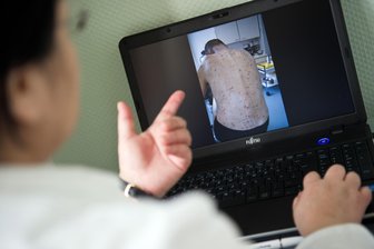 Tausende Sachsen leiden unter Krätze: Wie behandelt man sie am besten? - Kleine Bläschen, Pusteln und starker Juckreiz machen Patienten mit Krätze zu schaffen.