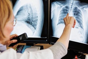Tuberkulose in Chemnitz: Zwei weitere Verdachtsfälle haben sich bestätigt - 28 Tuberkulosei-Infektionen wurden in Chemnitz mittlerweile nachgewiesen. Bei vier Personen kam es zu einer Erkrankung. 