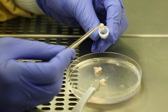 Überlebenschancen bei Krebs sind deutlich gestiegen - 