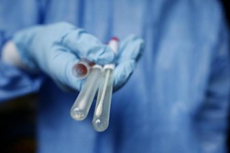 Vier neue Corona-Fälle in Chemnitz -