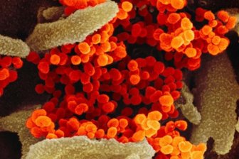 Virus schränkt öffentliches Leben ein - Der Coronavirus legt das Vogtland lahm. Zwei Fälle waren bis Montagabend für den Landkreis bestätigt. Die Illustration zeigt eine elektronenmikroskopische Virus-Aufnahme des "U.S. National Institute of Health". 