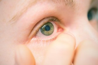 Von Schwarztee bis Wärme: Was bei Körnern am Augenlid hilft - Nicht rumdrücken, lieber beraten lassen: Bei stärkerer Entzündung kann eine antibiotische Augensalbe nötig sein – abklären in Praxis oder Apotheke.