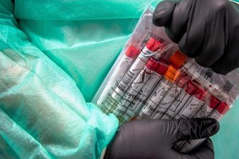 Vor Urlaubsreise: Große Preisspanne im Vogtlandkreis bei PCR-Tests - In einigen Urlaubsländern wird zur Einreise noch immer ein negativer PCR-Test vor der Einreise verlangt.