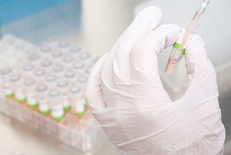 PCR-Tests im Labor.