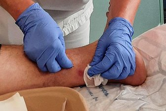 Warum im Risikogebiet Mittelsachsen ein Zeckenbiss kein Notfall ist - In der Zentralen Notaufnahme des Klinikums Mittweida wird bei einem Patienten eine Zecke entfernt. Doch meist reicht in solchen Fällen die Vorstellung beim Hausarzt.