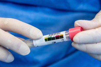 Eine Assistentin hält mit Schutzhandschuhen ein Probenröhrchen in den Händen .