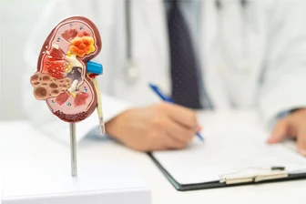 Wenn die Tablettenration halbiert werden muss: Nierenpatientin aus Zwickau geht der Vorrat aus - Ein Arzt mit dem Modell einer menschlichen Niere bei der Untersuchung und Behandlung im Krankenhaus.