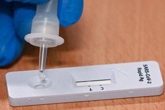 Wenn nicht das Amt Kontakte erfragt - Reagiert ein Coronatest positiv, dann könnten künftig im Erzgebirgskreis Mitarbeiter eines Callcenters im Auftrag des Landkreises bei Betroffenen zwecks der Kontaktnachverfolgung anrufen.