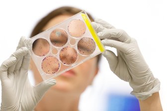 Wie Mediziner aus Chemnitz und Dresden Krebs besser bekämpfen wollen - Welche Krebsmedikamente wirken? Hier sind isolierte Tumorzellen zu sehen, die im Forschungslabor des Nationalen Centrums für Tumorerkrankungen Dresden auf ihr Ansprechen auf knapp 90 Wirkstoffe getestet werden.