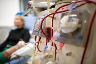 Wirksamkeit der Blutwäsche gegen Long Covid überprüft - Blutwäsche wird meist bei Nierenversagen angewendet. Gegen Long-Covid bieten Ärzte auch die Immun-Apherese an.