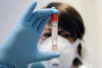 Zahl der Corona-Erkrankungen im Landkreis Zwickau steigt auf 221 - Die Zahl der mit dem Coronavirus infizierten Menschen im Landkreis Zwickau ist nochmals angestiegen.