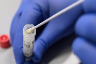 Zahl der Corona-Fälle im Landkreis Zwickau steigt auf 491 - Ein weiterer Todesfall - Die Zahl der nachgewiesenen Infektionen mit dem Coronavirus im Landkreis Zwickau ist bis Samstagvormittag auf 491 gestiegen.