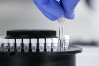 Zahl der Corona-Fälle in Westsachsen steigt auf 267 - Die Zahl der mit dem Coronavirus infizierten Personen im Landkreis Zwickau ist bis Freitagvormittag auf 267 angestiegen.