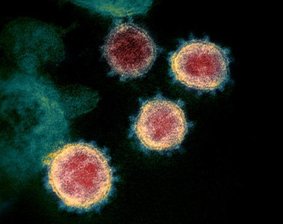 Zahl der Corona-Toten in Sachsen steigt auf neun - Undatierte elektronenmikroskopische Aufnahme, die von den U.S. National Institutes of Health im Februar 2020 zur Verfügung gestellt wurde, zeigt das Virus, das Covid-19 verursacht