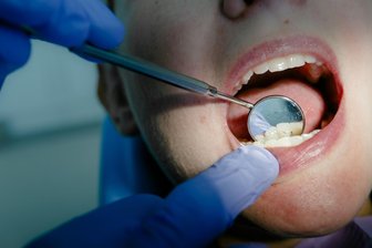 Zahnarzt-Notdienste im Erzgebirge neu geregelt: Was Patienten dazu wissen sollten - Plötzlich Zahnschmerzen am Wochenende? Die Kassenzahnärztliche Vereinigung Sachsen hat die Zahnarzt-Notdienste auch im Erzgebirge neu geregelt.