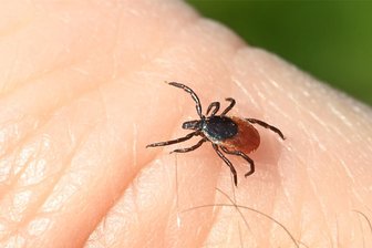 Zecken-Plage: Auch in Mittelsachsen steigt das Risiko - Nach Ausflügen in die Natur sollte man seinen Körper nach Zecken absuchen.