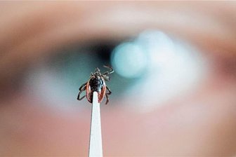 Zeckenbiss: Im Risikogebiet Mittelsachsen sind Erkrankungen selten - Zecken können Überträger von Borreliose und Frühsommer-Meningoenzephalitis (FSME) sein.