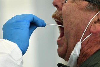 Zehn neue Corona-Infektionen in Sachsen - kein weiterer Todesfall -