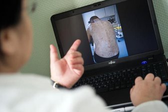 Zschopau: Krätze im Erzgebirgskreis auf dem Vormarsch - 