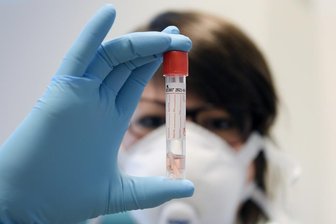 Zwei Mitarbeiter im Krankenhaus Mittweida positiv auf Coronavirus getestet -