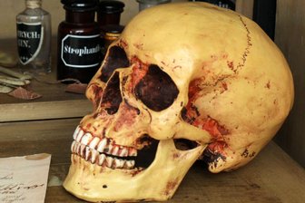 Zwickauer Knochenfunde: Fälle beschäftigen Zwickauer Ermittler noch immer - Ein menschlicher Schädel ähnlich diesem wurde in Zwickau entdeckt.